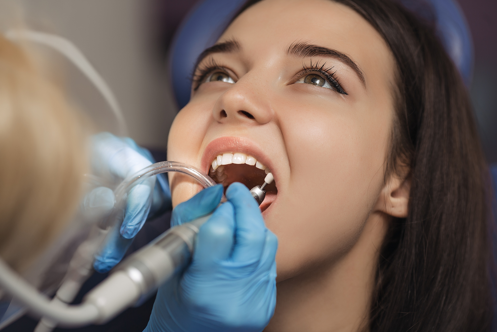 Essential Dental Implant Aftercare: Tips for a Successful Recovery and Long-Term Success