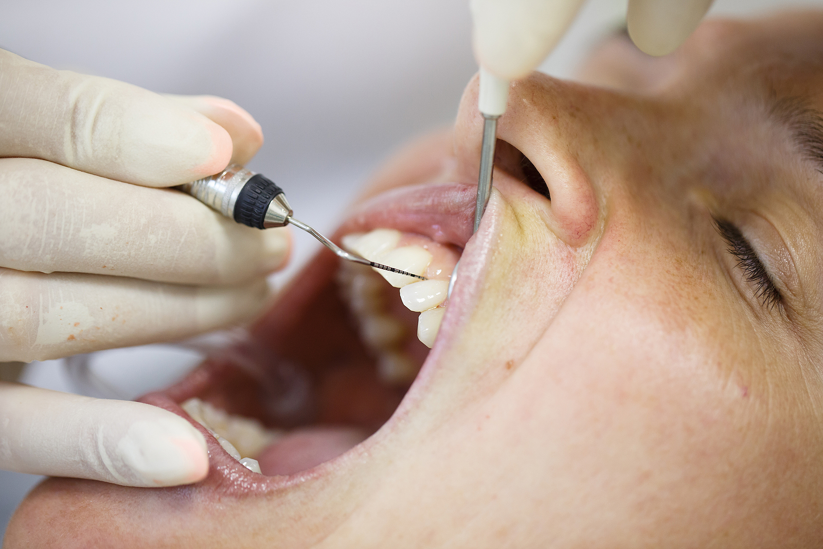 The Intersection of Periodontics and Medicine in Palm Desert, CA: Enhancing Oral and Overall Health