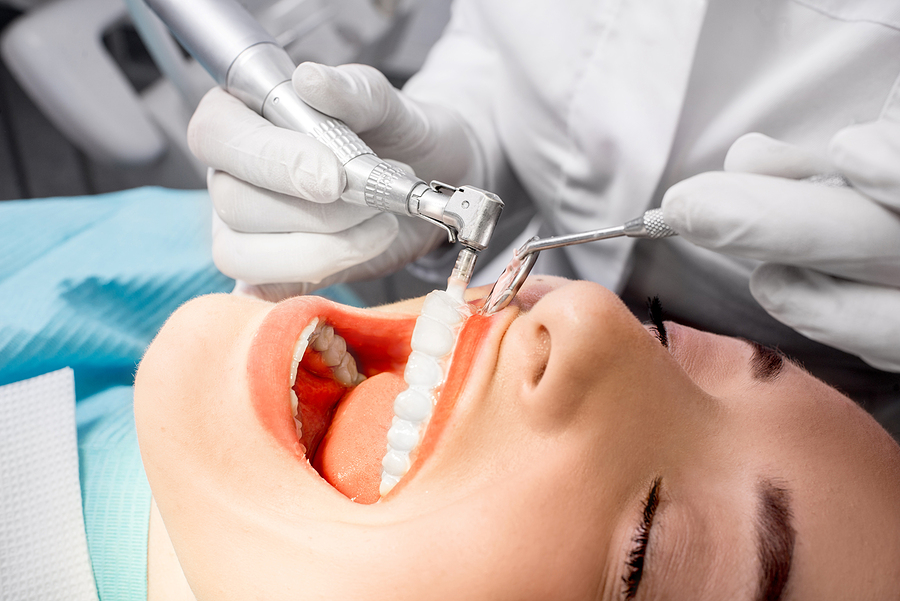 Maintaining Optimal Oral Health with Professional Teeth Cleaning in Palm Desert, CA