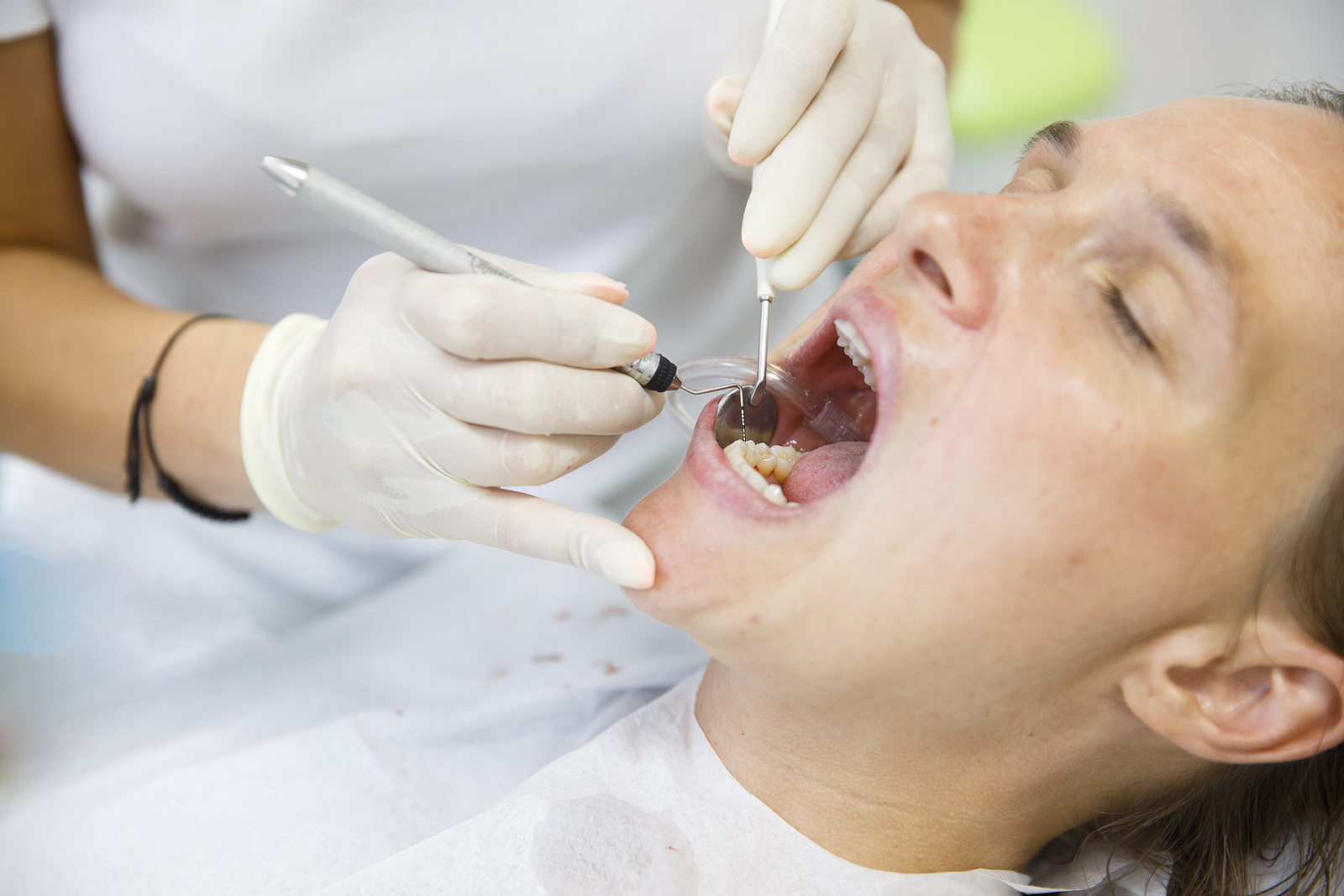 Tooth Extraction Aftercare 101: Essential Tips for a Smooth Recovery
